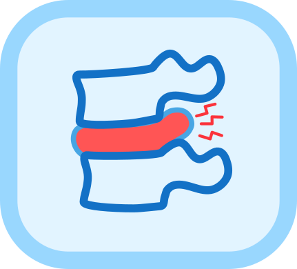 Hernia discal